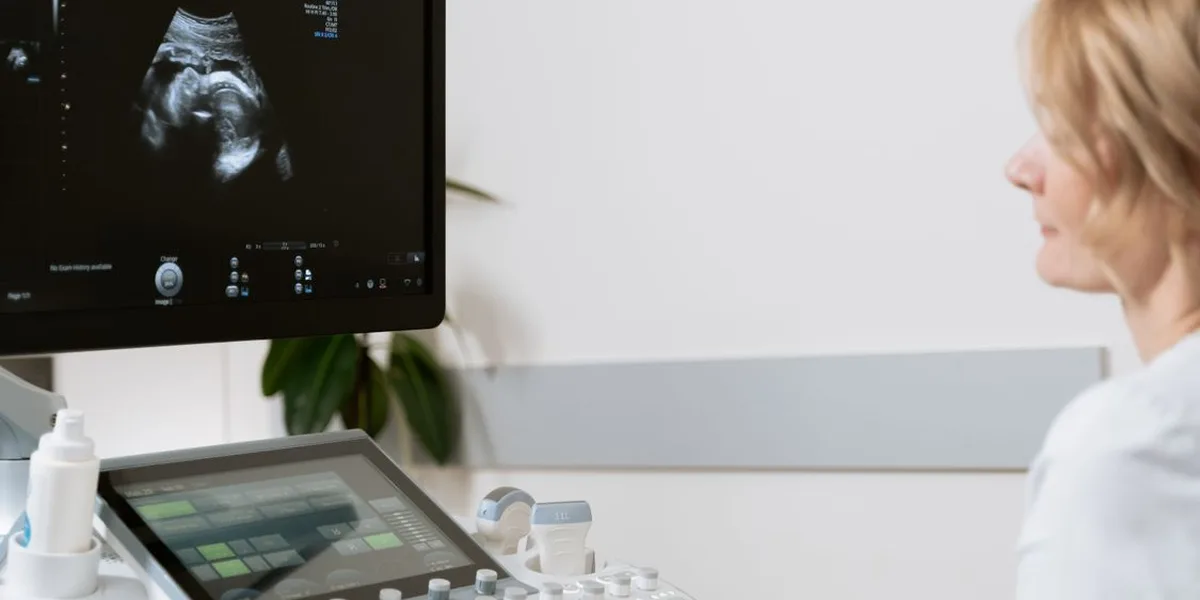 Sonographer – Fertility and Reproductive Imaging workplace — Dubai, UAE